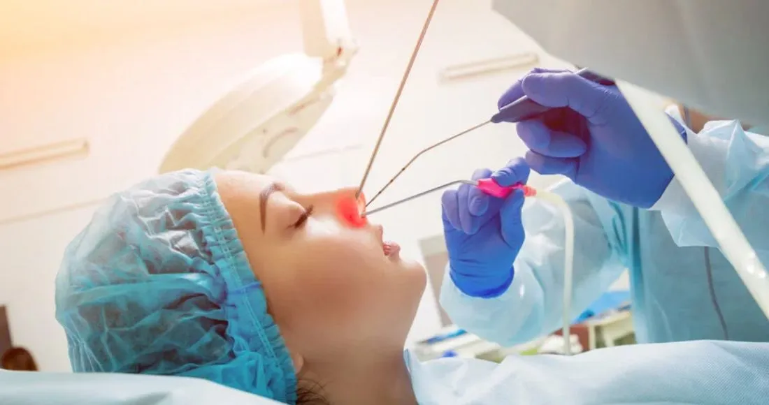 Can Nasal Polyps Removed Without Surgery