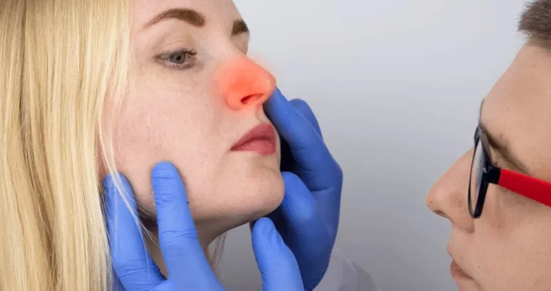 Is nasal polyps dangerous