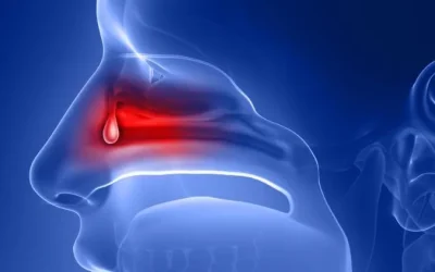 Nasal Polyps vs. Nasal Tumors: What’s the Difference?