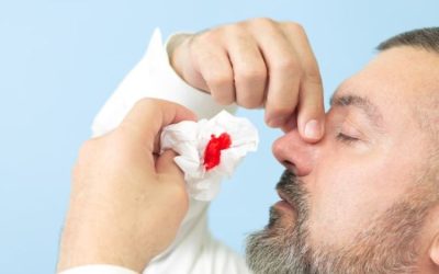 High Blood Pressure & Nosebleeds: Causes & Care